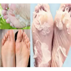 Отзыв о Носки педикюрные пилинговые MiFo Super Exfoliating Foot Socks For Pedicure