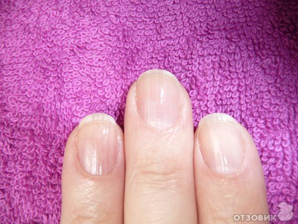 Ногти слоятся что делать в домашних. Секутся и выпадают волосы слоятся и ломаются ногти. Как укрепить ногти от расслаивания.