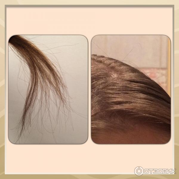 Восстановление густоты волос отзывы. Определить густоту волос. Густота волос 14 см. Малая густота волос. Вернуть густоту волос.