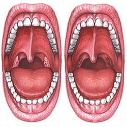 Воспалилась Миндалина Справа